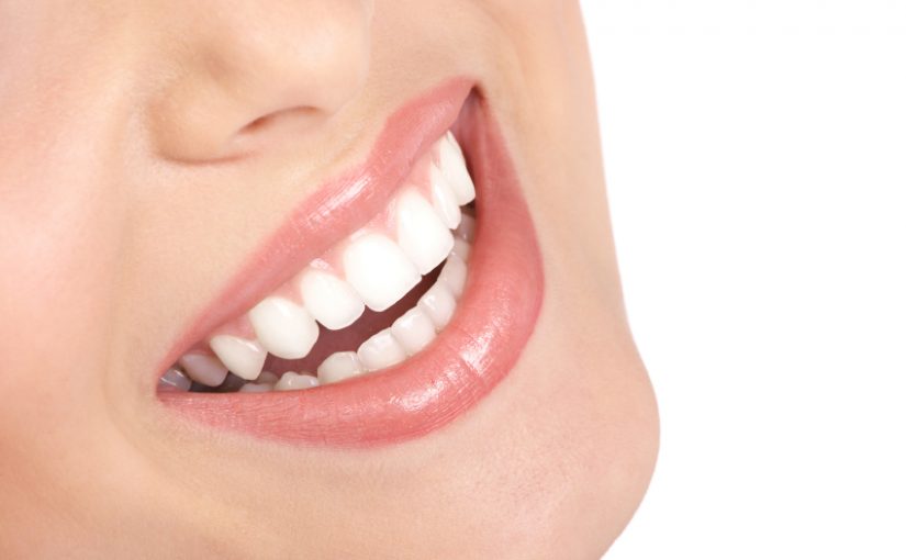 dental fillings cost