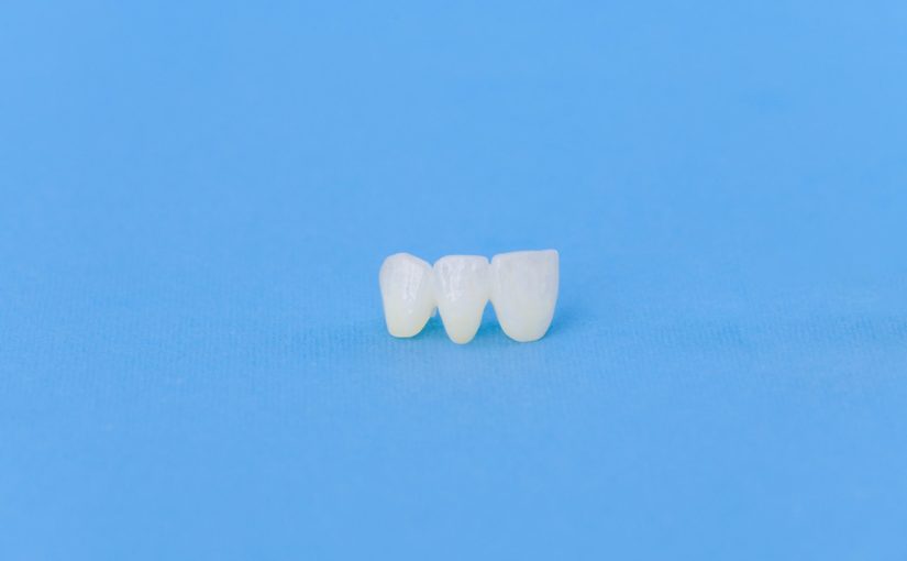 Why Are Dental Crowns Important, and Which Dentist Can Treat Me